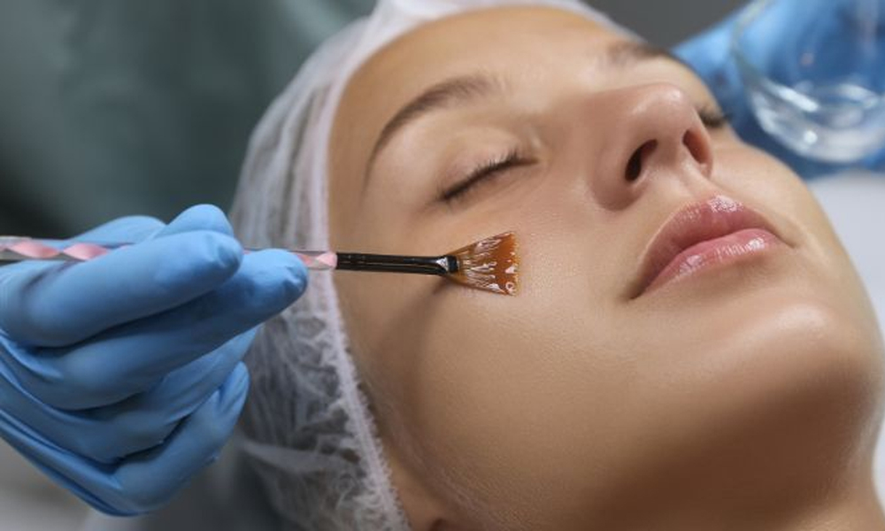Best Clinic for Chemical Peel in Kathmandu