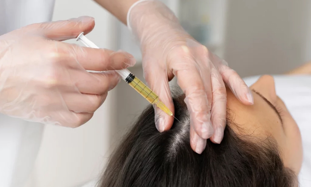 Best Hospital for PRP Treatment in Kathmandu